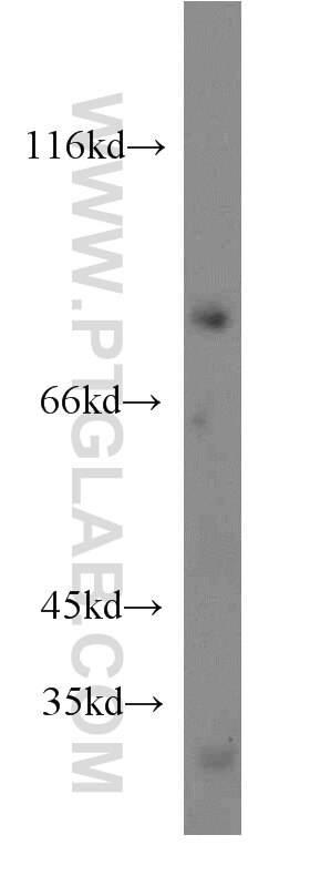 Western Blot (WB) analysis of K-562 cells using FGD3 Polyclonal antibody (20347-1-AP)