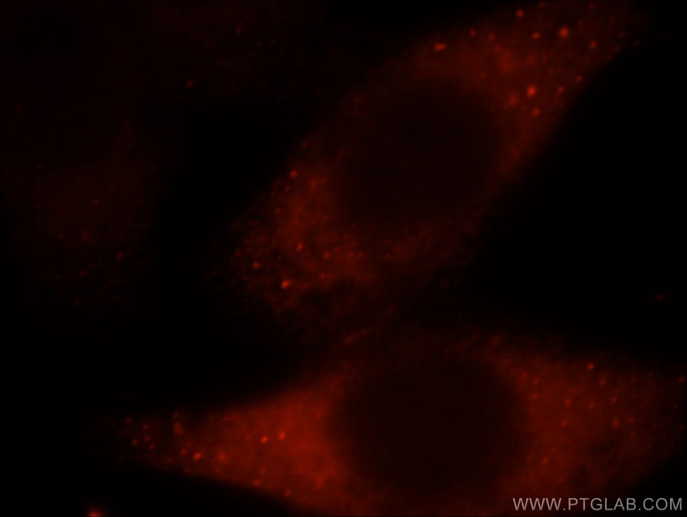 Immunofluorescence (IF) / fluorescent staining of HeLa cells using FGD5 Polyclonal antibody (20910-1-AP)