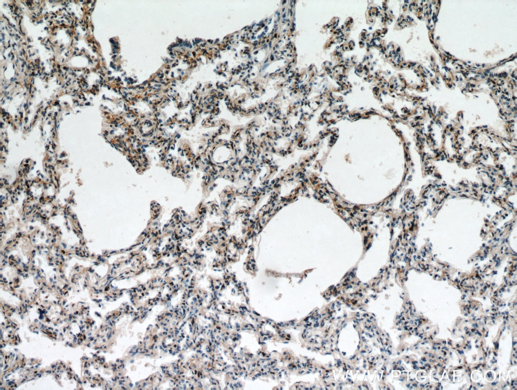 Immunohistochemistry (IHC) staining of human lung tissue using FGD5 Polyclonal antibody (20910-1-AP)