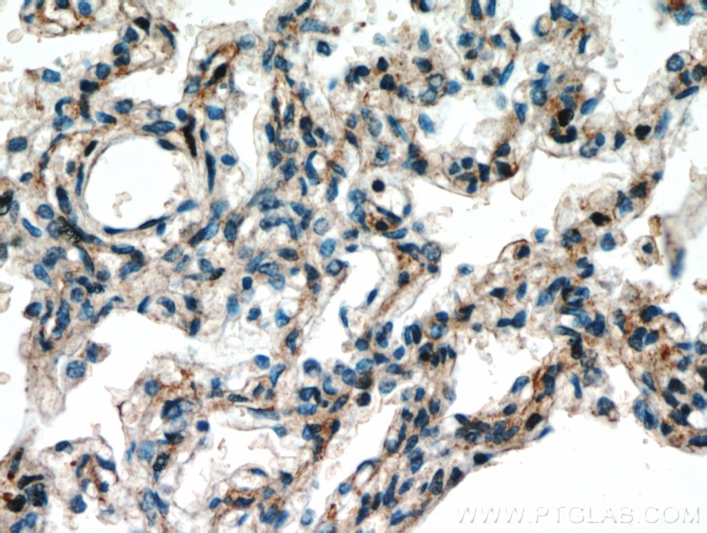 Immunohistochemistry (IHC) staining of human lung tissue using FGD5 Polyclonal antibody (20910-1-AP)