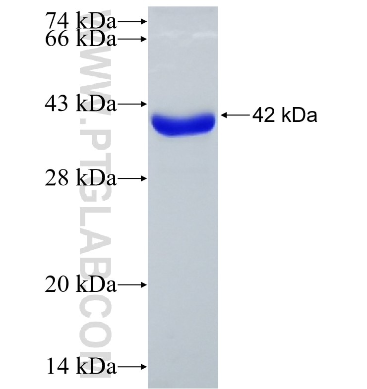 FGD5 fusion protein Ag15446 SDS-PAGE
