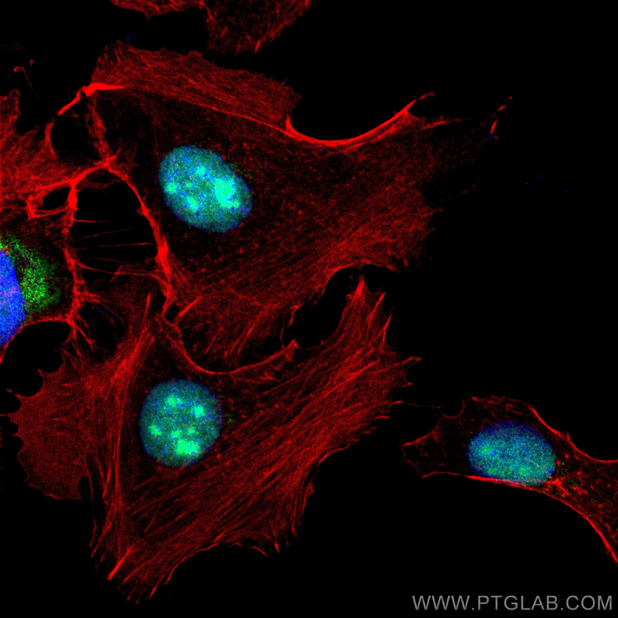 Immunofluorescence (IF) / fluorescent staining of SKOV-3 cells using FGF-2 Polyclonal antibody (30333-1-AP)