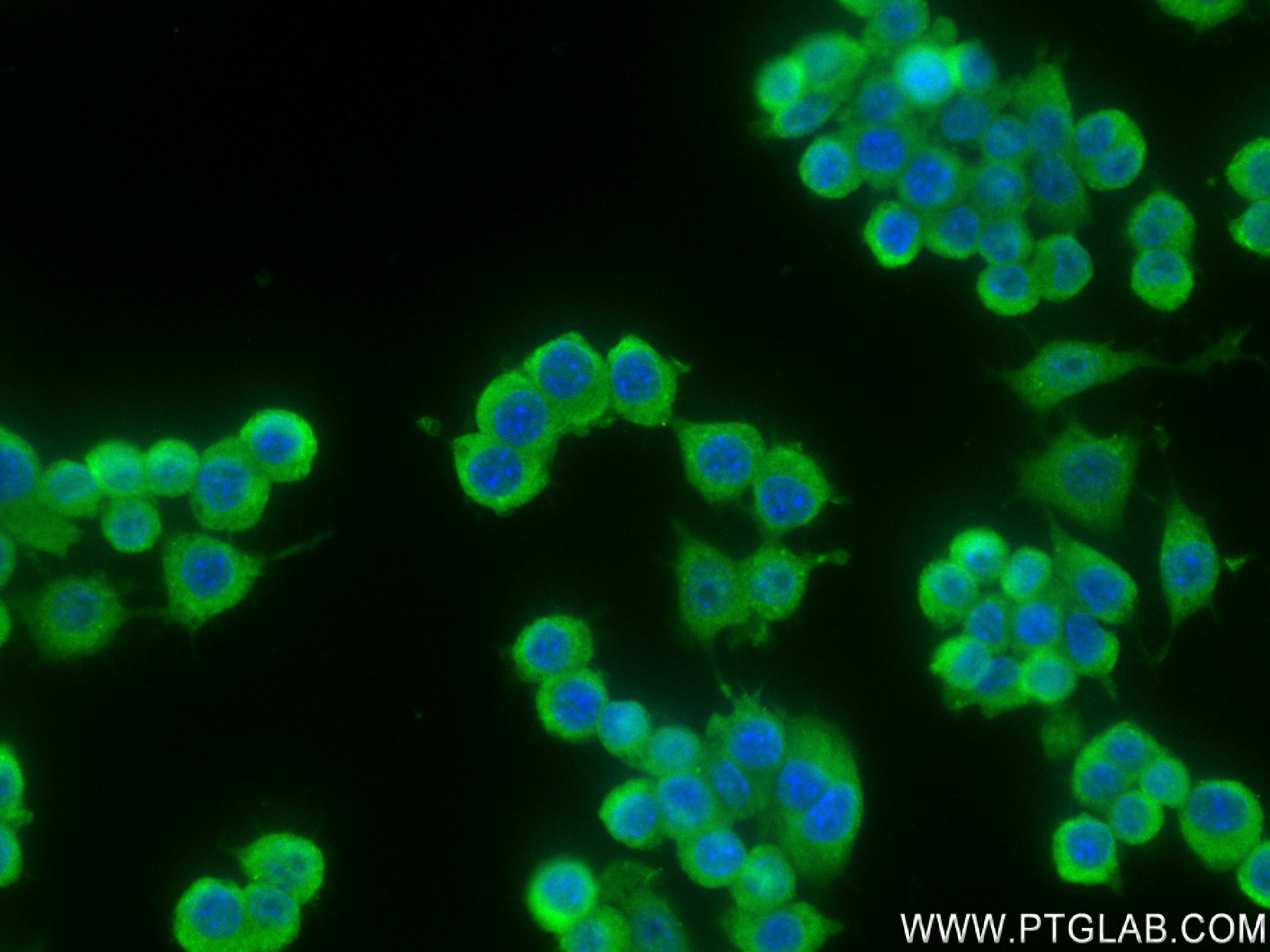 Immunofluorescence (IF) / fluorescent staining of RAW 264.7 cells using FGF-21 Recombinant antibody (82706-6-RR)