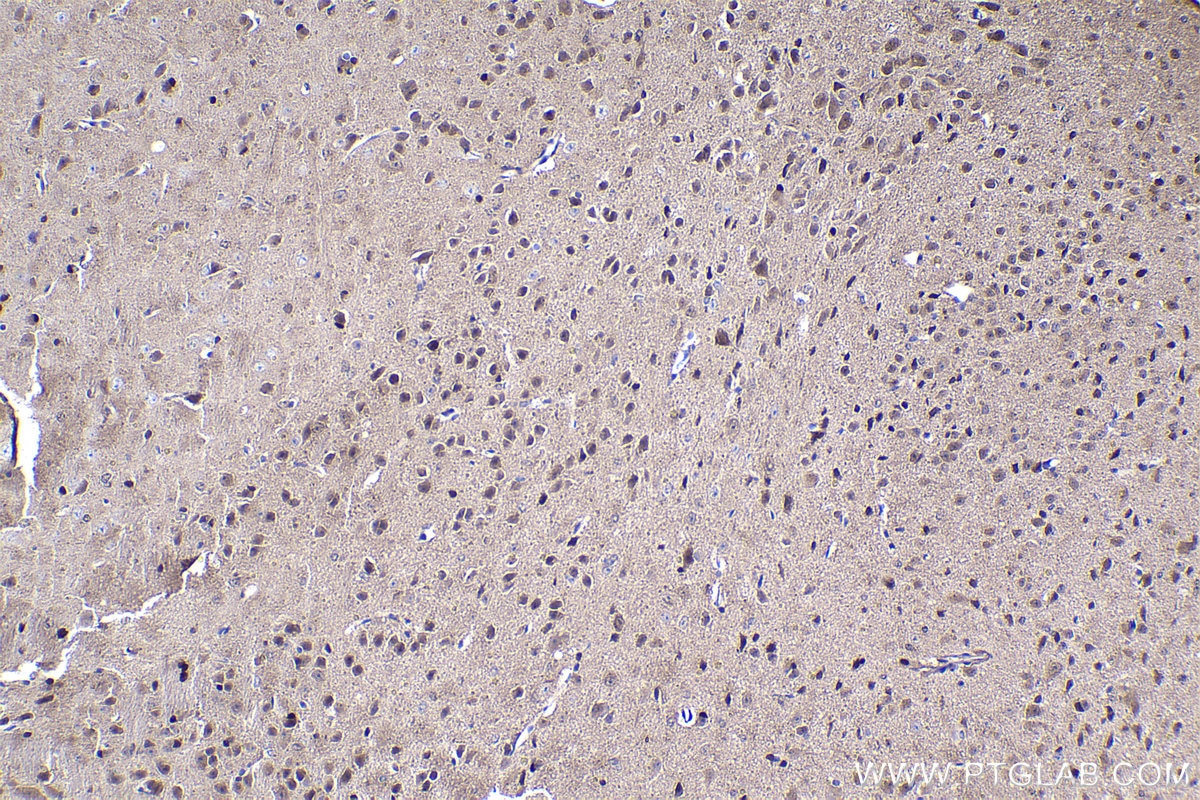 Immunohistochemistry (IHC) staining of mouse brain tissue using FGF1 Polyclonal antibody (17400-1-AP)