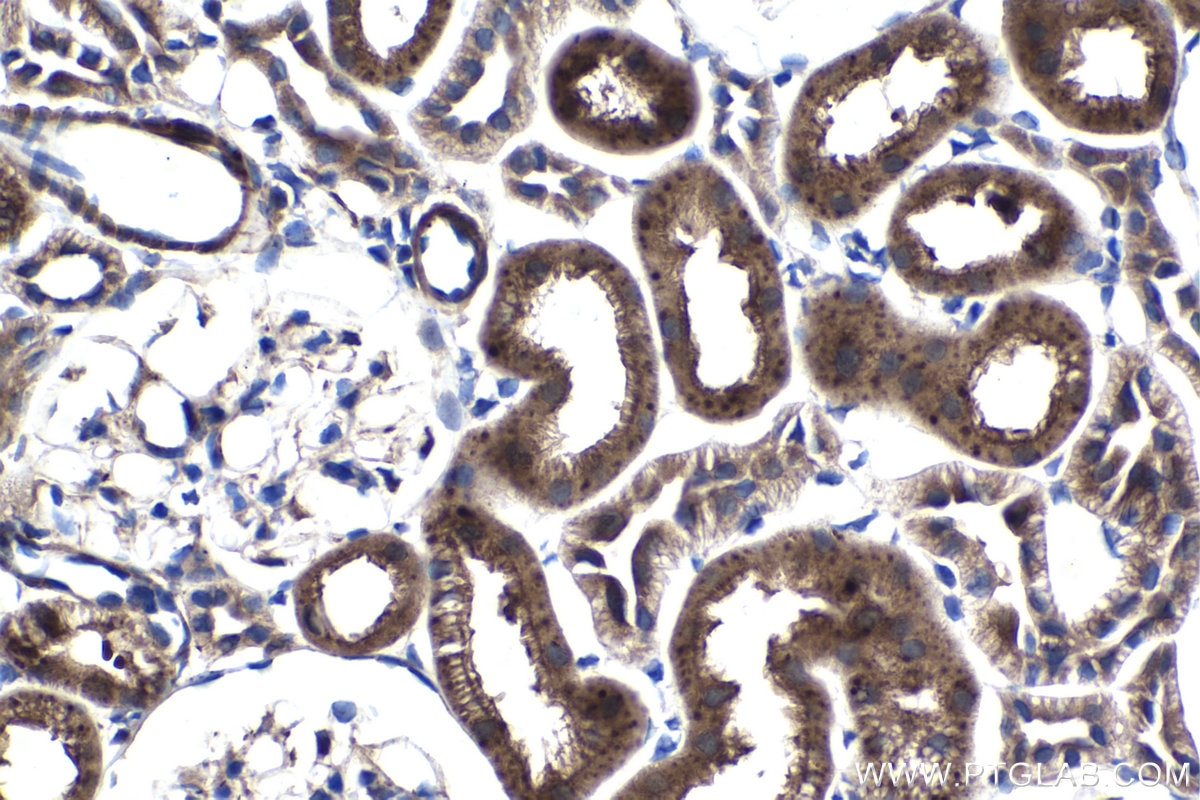 Immunohistochemistry (IHC) staining of rat kidney tissue using FGF1 Polyclonal antibody (17400-1-AP)