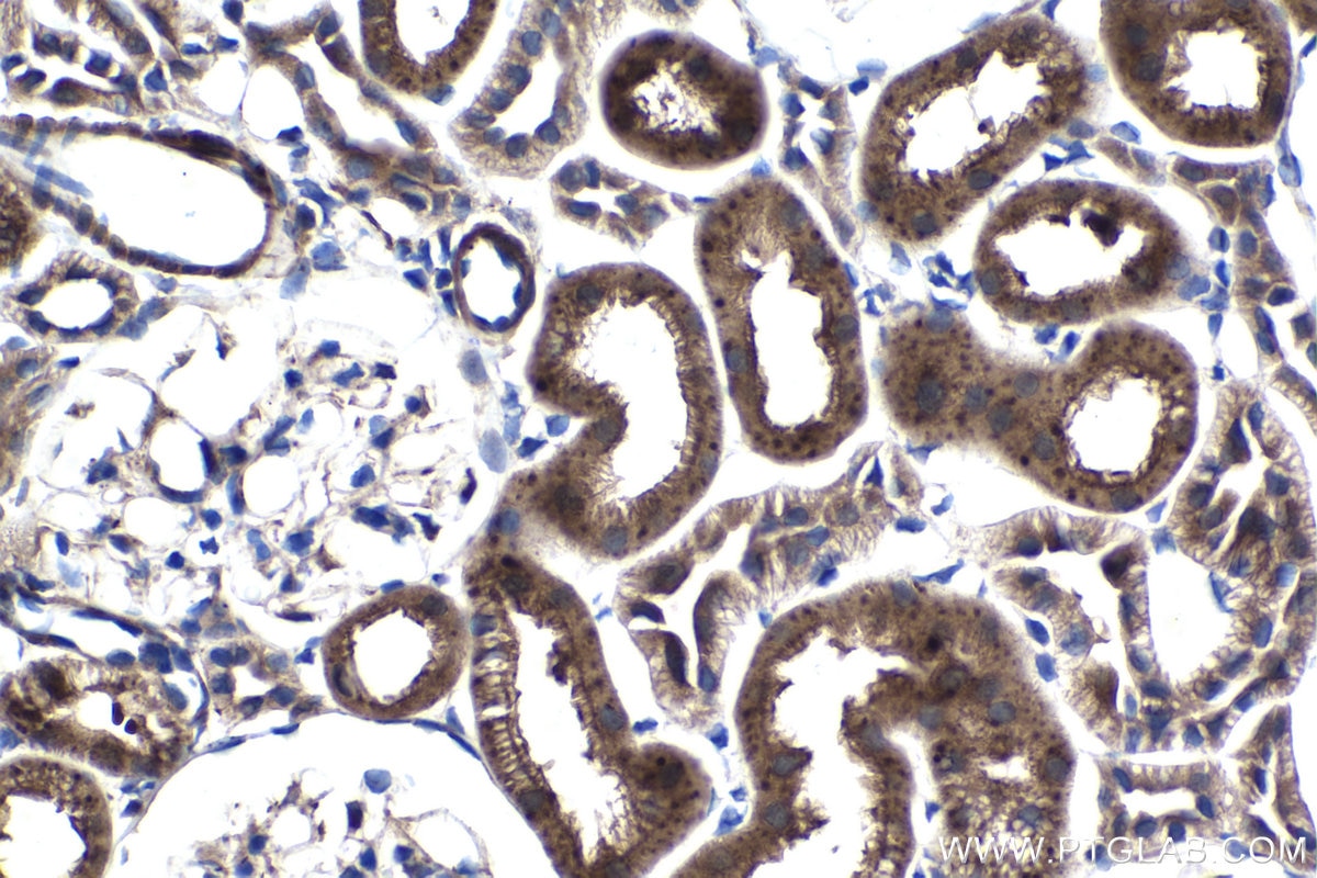 IHC staining of rat kidney using 17400-1-AP