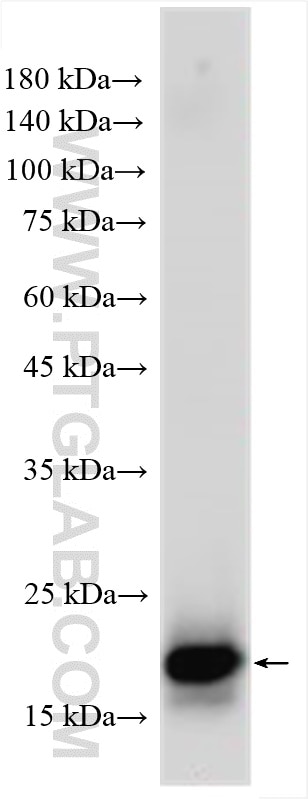 WB analysis of mouse spinal cord using 17400-1-AP