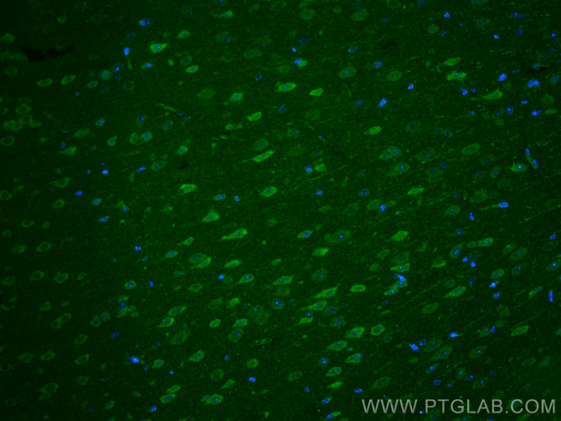 Immunofluorescence (IF) / fluorescent staining of mouse brain tissue using FGF10 Polyclonal antibody (29749-1-AP)