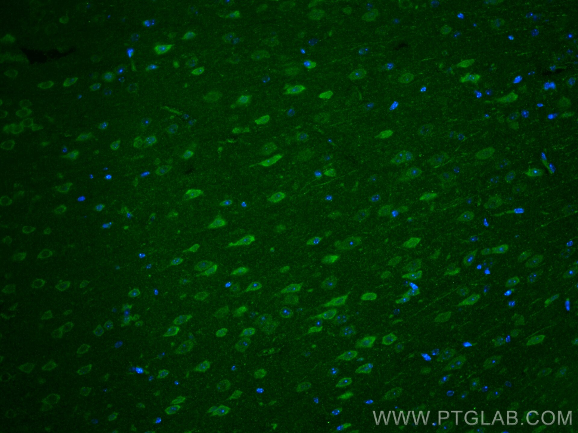 Immunofluorescence (IF) / fluorescent staining of mouse brain tissue using FGF10 Polyclonal antibody (29749-1-AP)