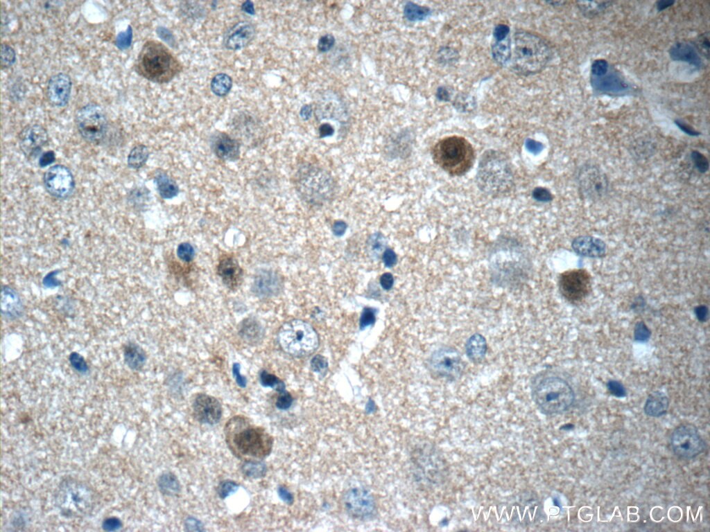 Immunohistochemistry (IHC) staining of mouse brain tissue using FGF12 Polyclonal antibody (13784-1-AP)