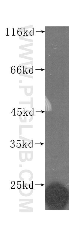 Western Blot (WB) analysis of human brain tissue using FGF12 Monoclonal antibody (60152-1-Ig)