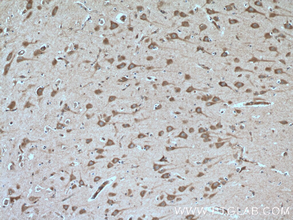 Immunohistochemistry (IHC) staining of human brain tissue using FGF13 Polyclonal antibody (26235-1-AP)