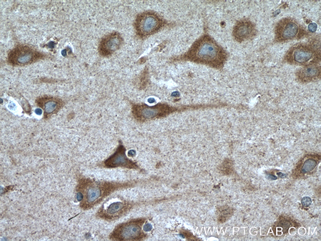 Immunohistochemistry (IHC) staining of human brain tissue using FGF13 Polyclonal antibody (26235-1-AP)