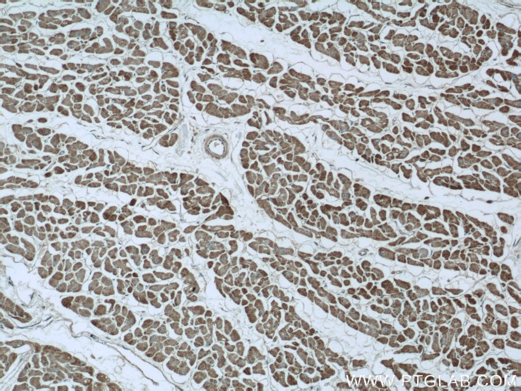 Immunohistochemistry (IHC) staining of human heart tissue using FGF16-Specific Polyclonal antibody (16876-1-AP)