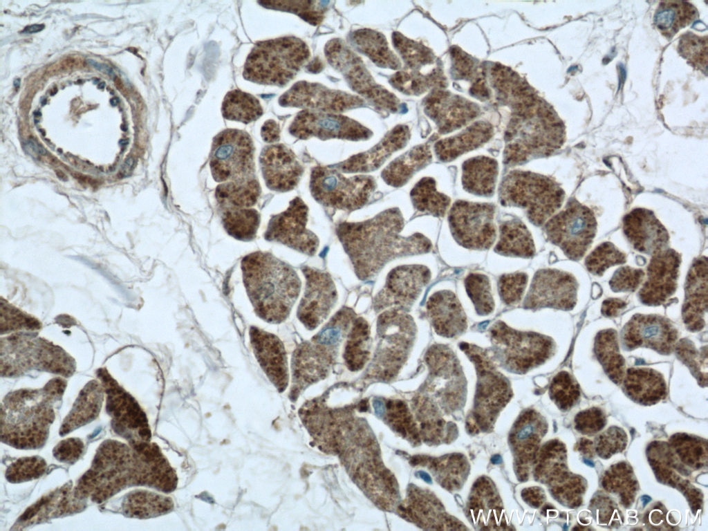 Immunohistochemistry (IHC) staining of human heart tissue using FGF16-Specific Polyclonal antibody (16876-1-AP)