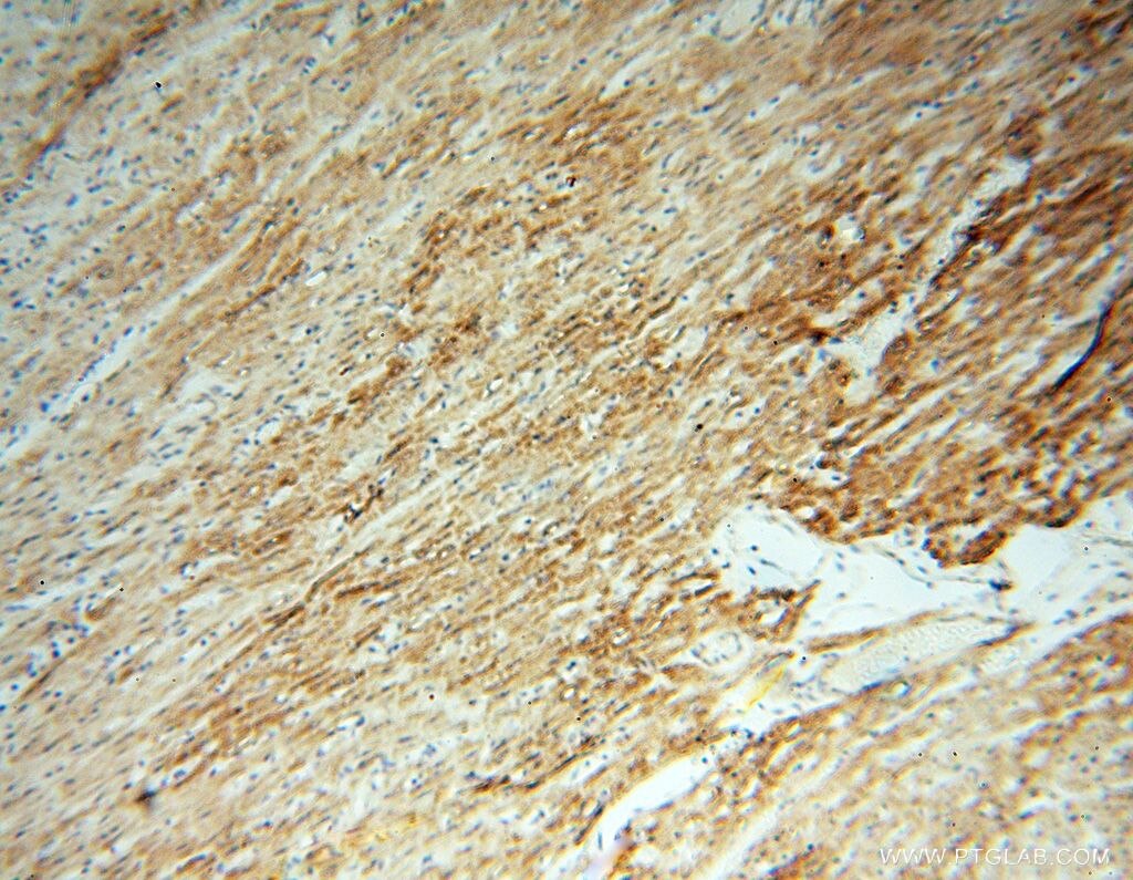 Immunohistochemistry (IHC) staining of human heart tissue using FGF16-Specific Polyclonal antibody (16876-1-AP)