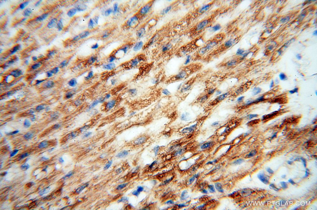 Immunohistochemistry (IHC) staining of human heart tissue using FGF16-Specific Polyclonal antibody (16876-1-AP)