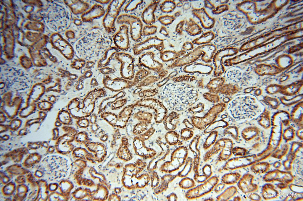 Immunohistochemistry (IHC) staining of human kidney tissue using FGF16-Specific Polyclonal antibody (16876-1-AP)