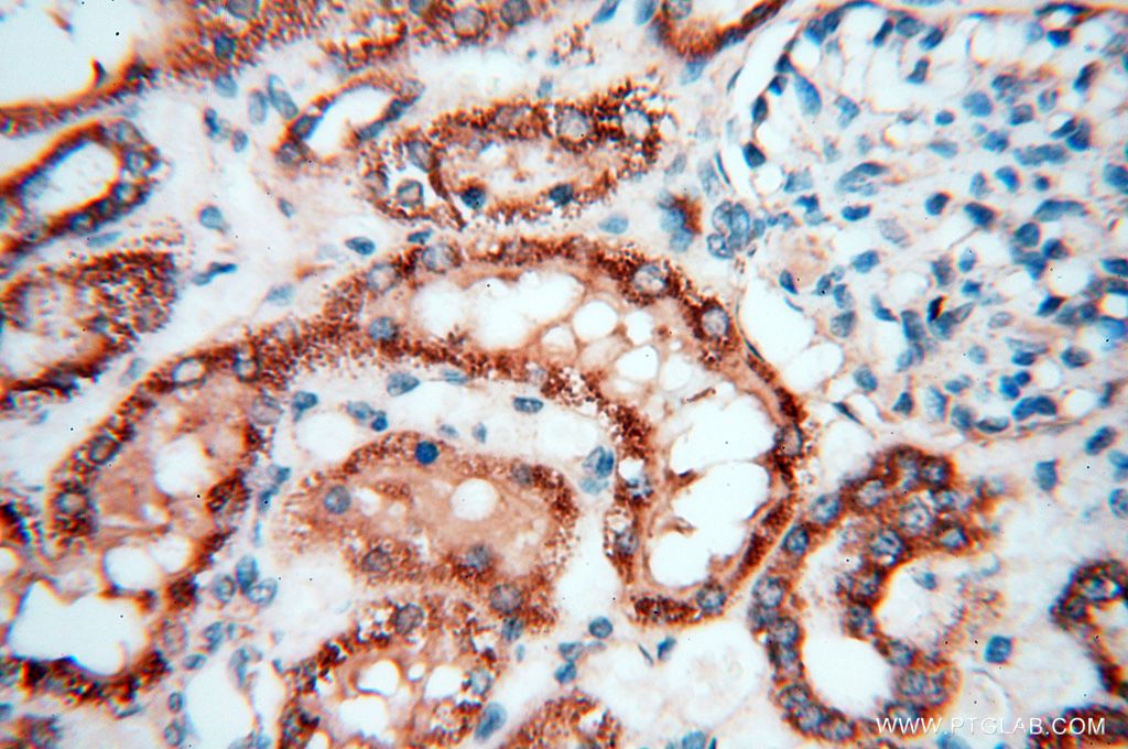 Immunohistochemistry (IHC) staining of human kidney tissue using FGF16-Specific Polyclonal antibody (16876-1-AP)