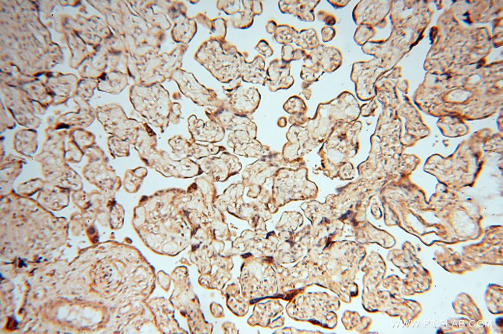 Immunohistochemistry (IHC) staining of human placenta tissue using FGF16-Specific Polyclonal antibody (16876-1-AP)