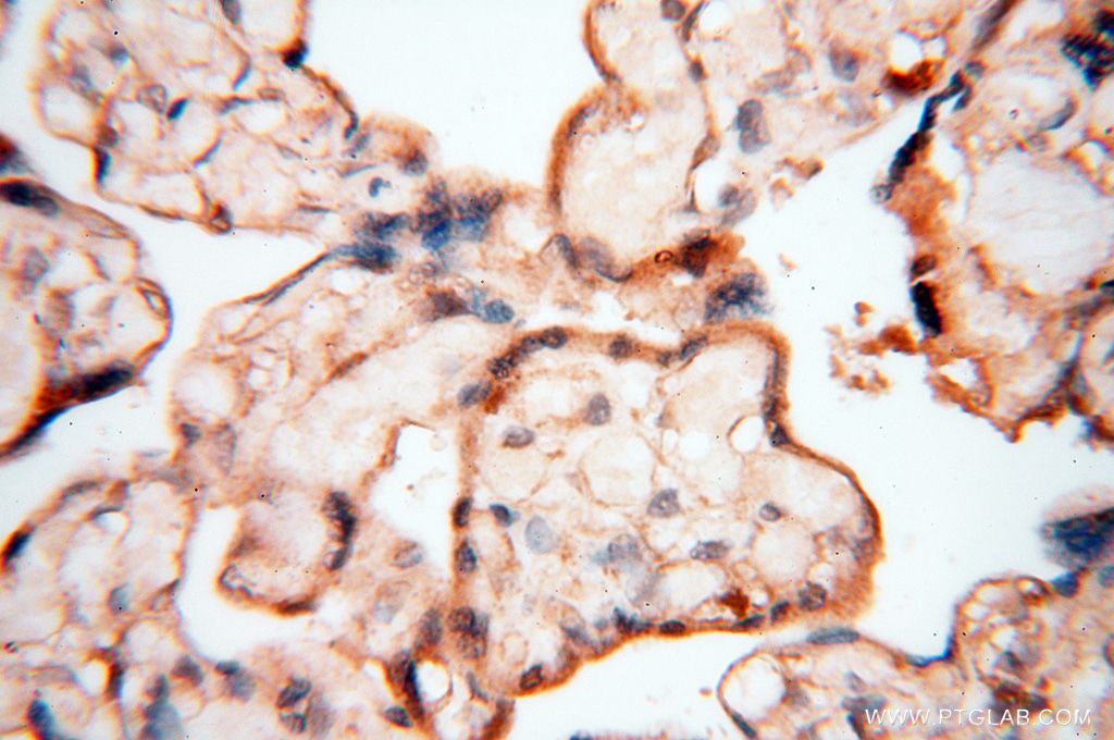 IHC staining of human placenta using 16876-1-AP