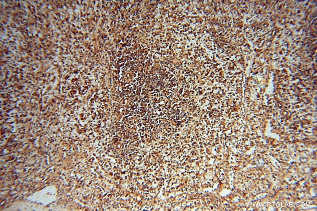 Immunohistochemistry (IHC) staining of human spleen tissue using FGF16-Specific Polyclonal antibody (16876-1-AP)