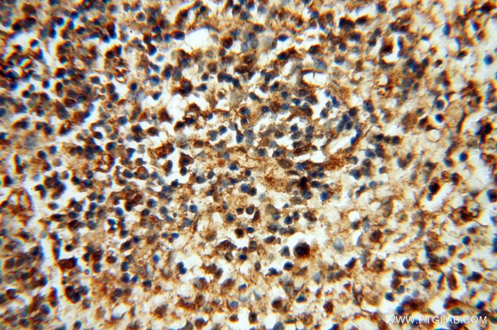 Immunohistochemistry (IHC) staining of human spleen tissue using FGF16-Specific Polyclonal antibody (16876-1-AP)