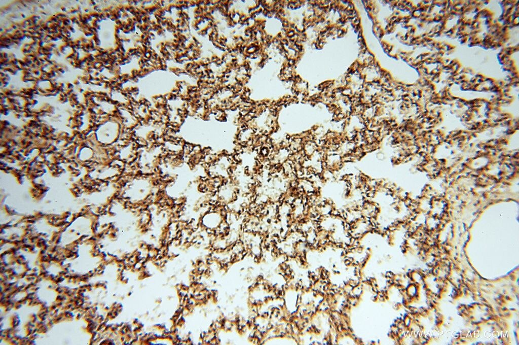 Immunohistochemistry (IHC) staining of human lung tissue using FGF16-Specific Polyclonal antibody (16876-1-AP)