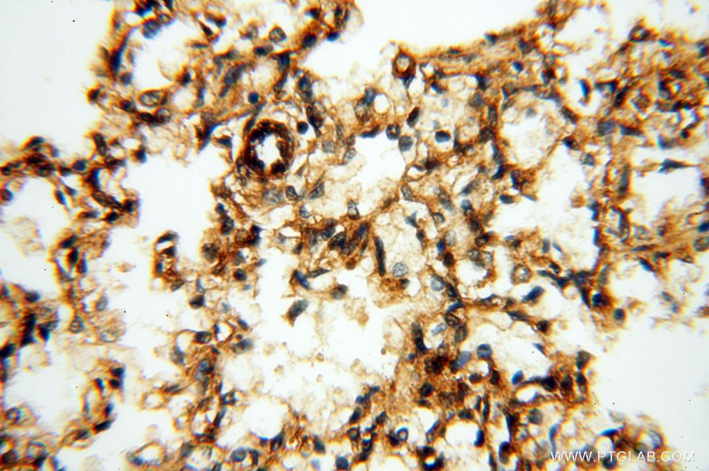 Immunohistochemistry (IHC) staining of human lung tissue using FGF16-Specific Polyclonal antibody (16876-1-AP)