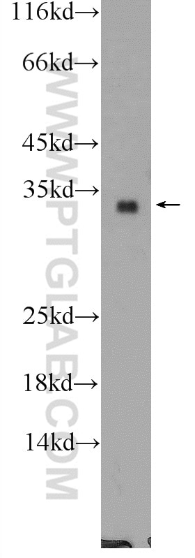 Western Blot (WB) analysis of MCF-7 cells using FGF17 Polyclonal antibody (25314-1-AP)