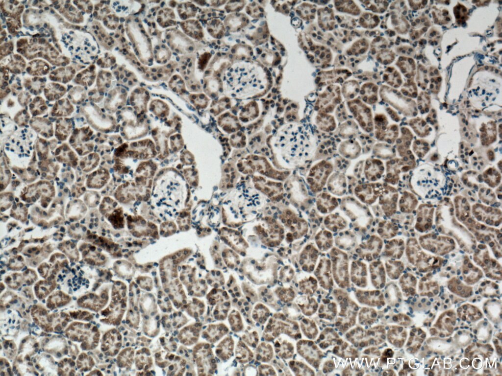 Immunohistochemistry (IHC) staining of mouse kidney tissue using FGF18 Polyclonal antibody (11495-1-AP)