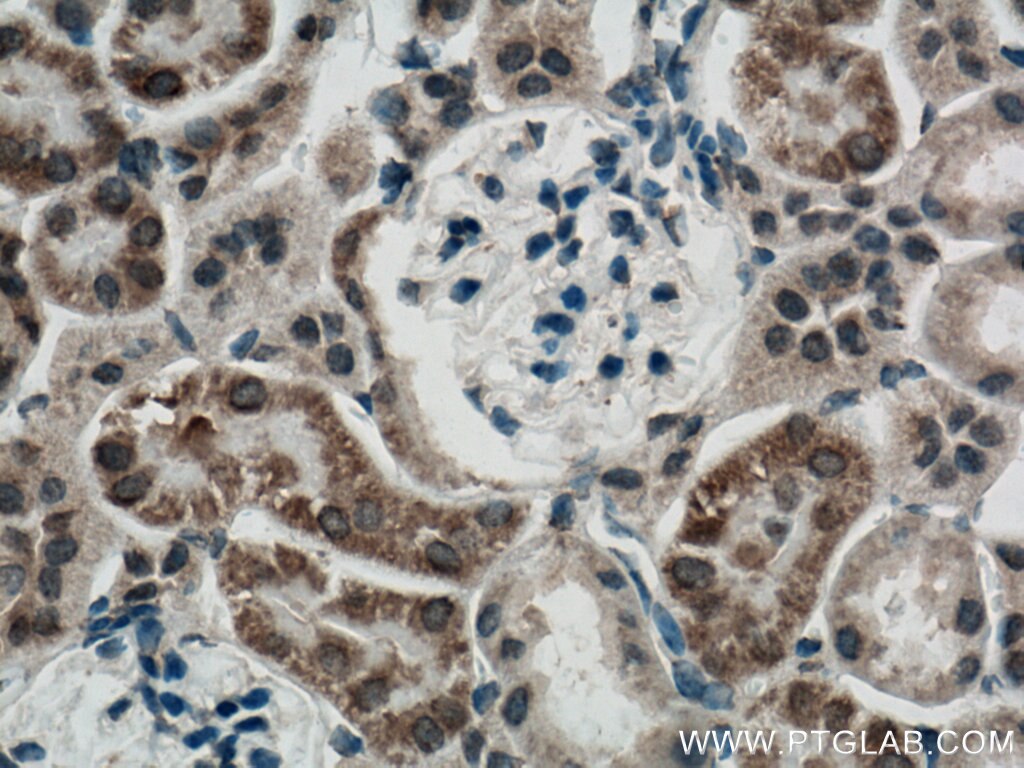 Immunohistochemistry (IHC) staining of mouse kidney tissue using FGF18 Polyclonal antibody (11495-1-AP)