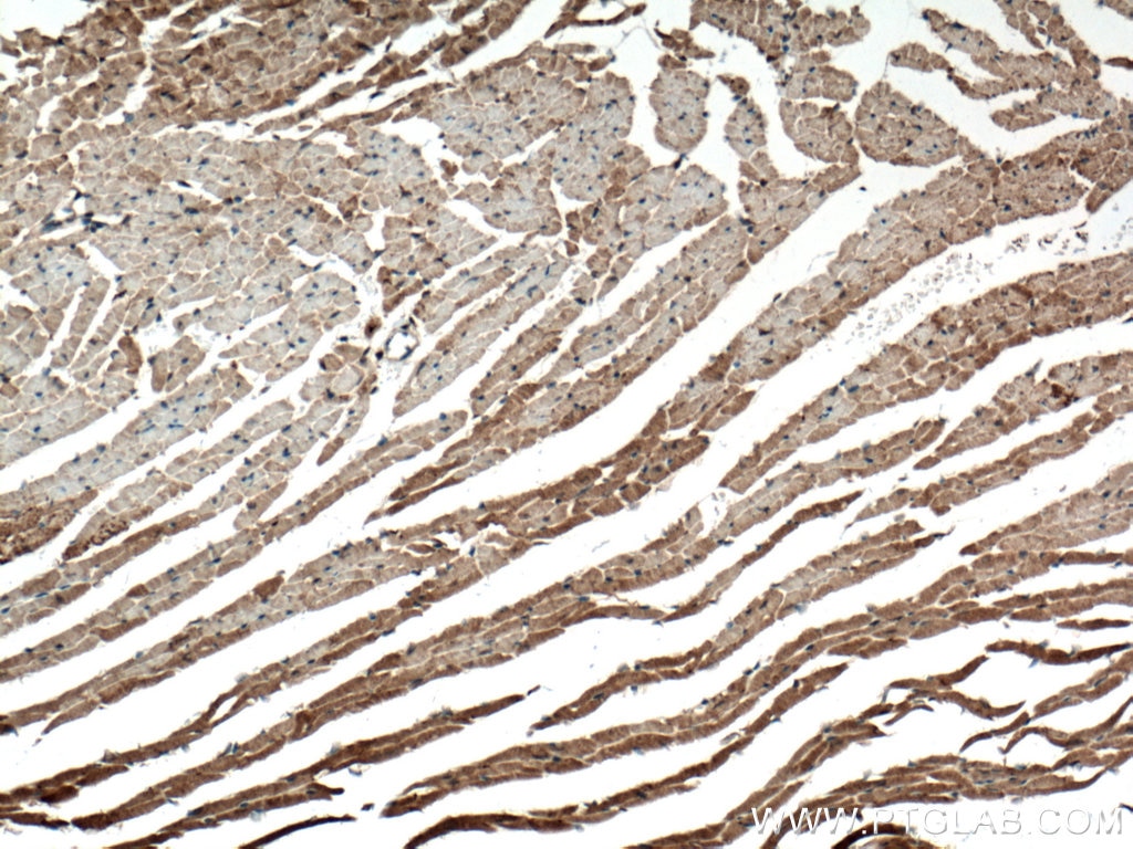 Immunohistochemistry (IHC) staining of mouse heart tissue using FGF18 Polyclonal antibody (11495-1-AP)