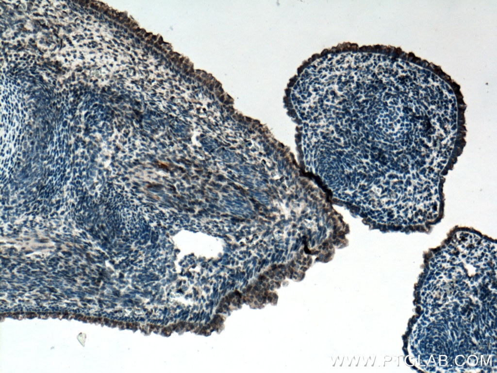 Immunohistochemistry (IHC) staining of mouse embryo tissue using FGF18 Polyclonal antibody (11495-1-AP)