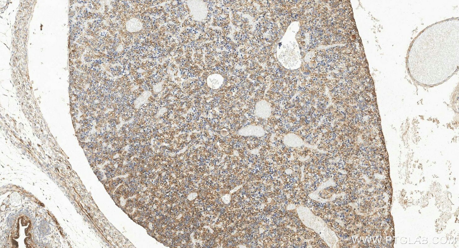 IHC staining of mouse embryo using 11495-1-AP Immunohistochemistry (IHC) staining of mouse embryo tissue using FGF18 Polyclonal antibody (11495-1-AP)