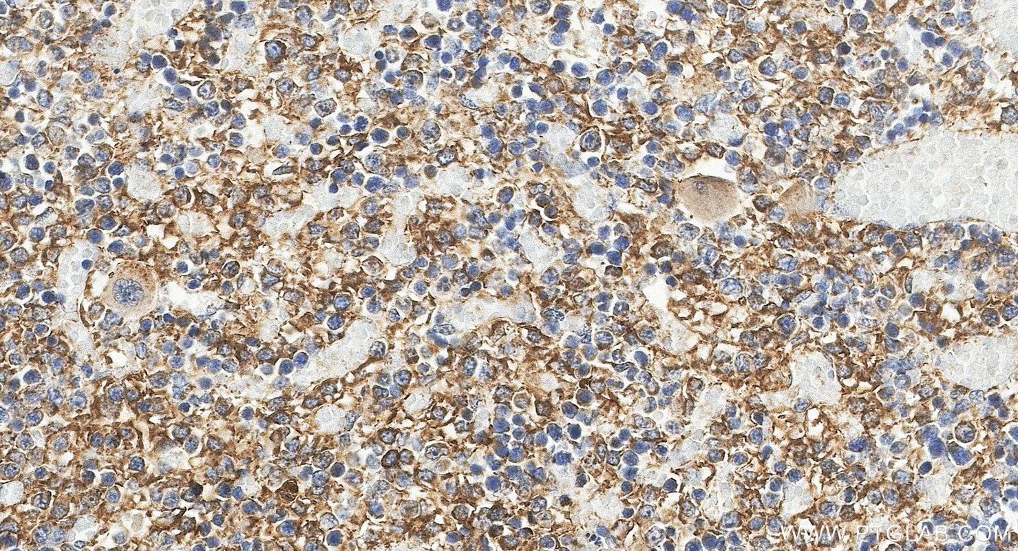 IHC staining of mouse embryo using 11495-1-AP Immunohistochemistry (IHC) staining of mouse embryo tissue using FGF18 Polyclonal antibody (11495-1-AP)