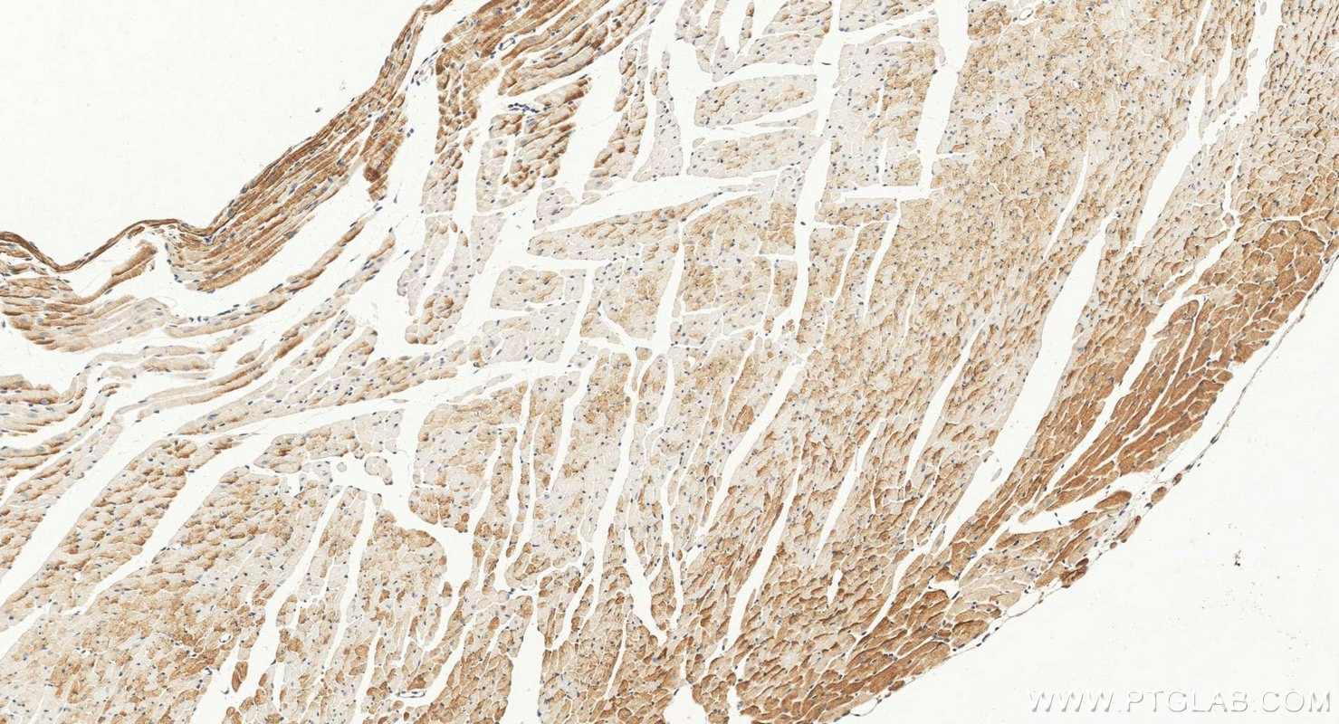 IHC staining of mouse heart using 11495-1-AP Immunohistochemistry (IHC) staining of mouse heart tissue using FGF18 Polyclonal antibody (11495-1-AP)