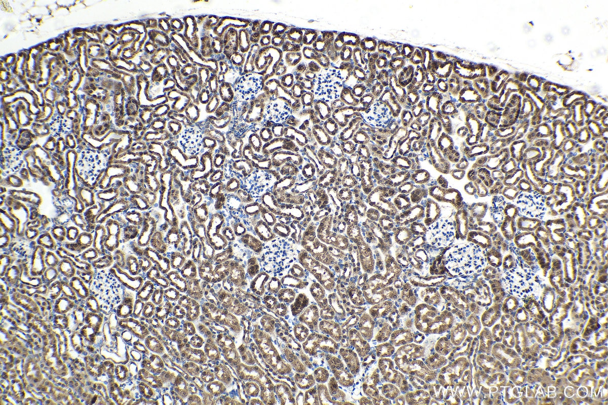 Immunohistochemistry (IHC) staining of mouse kidney tissue using FGF-2 Polyclonal antibody (11234-1-AP)