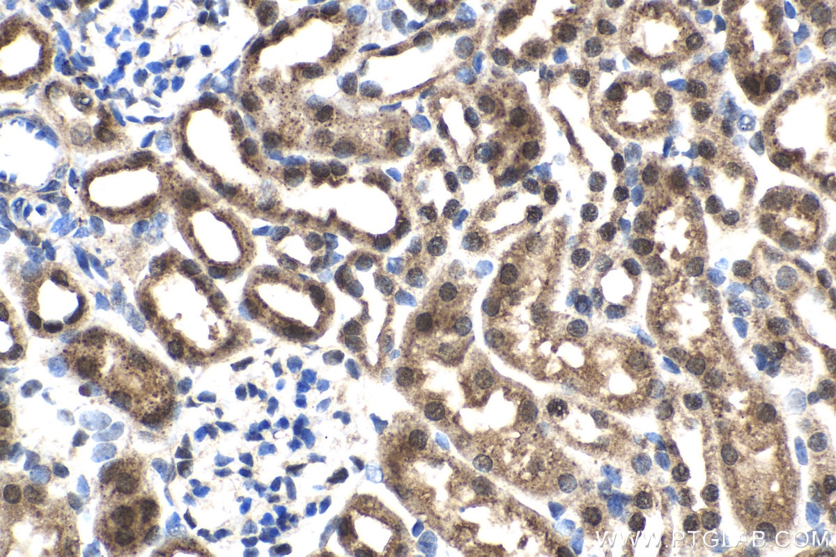 Immunohistochemistry (IHC) staining of mouse kidney tissue using FGF-2 Polyclonal antibody (11234-1-AP)