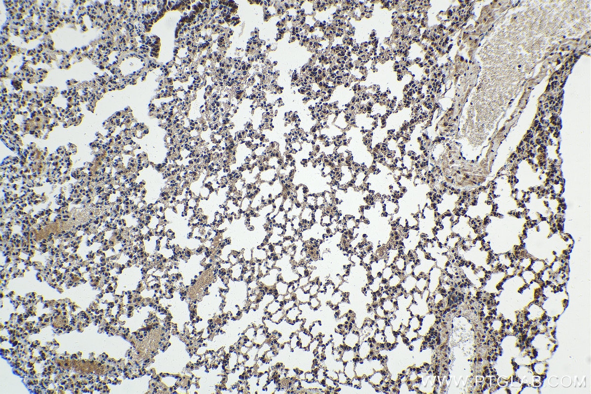 IHC staining of mouse lung using 11234-1-AP