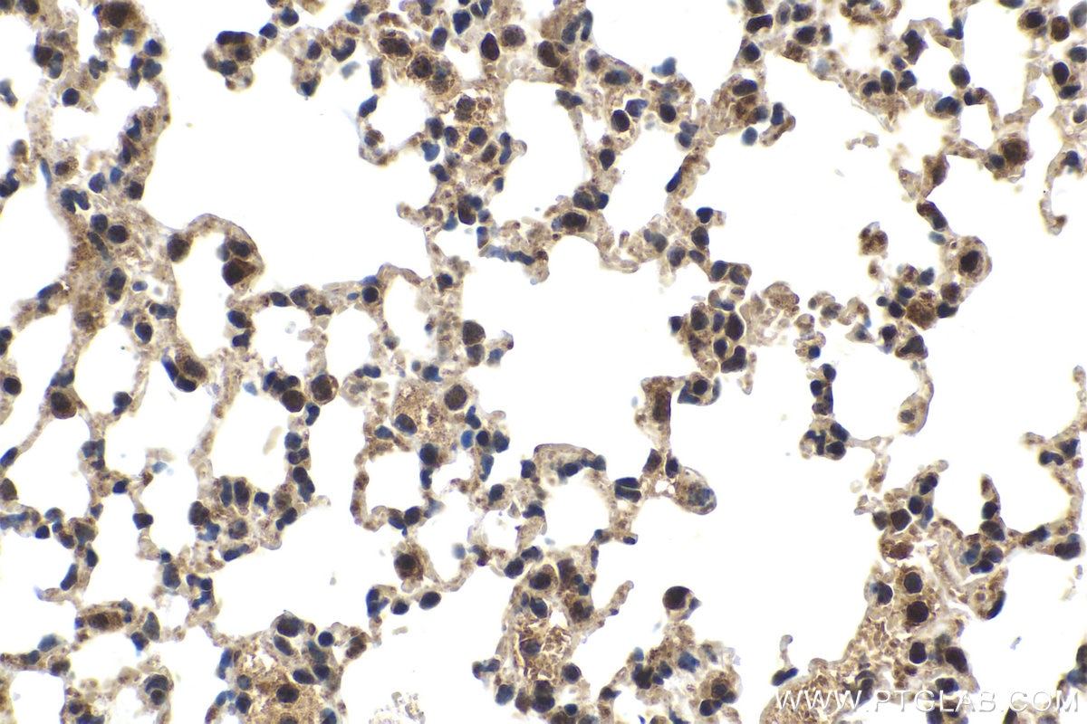 Immunohistochemistry (IHC) staining of mouse lung tissue using FGF-2 Polyclonal antibody (11234-1-AP)