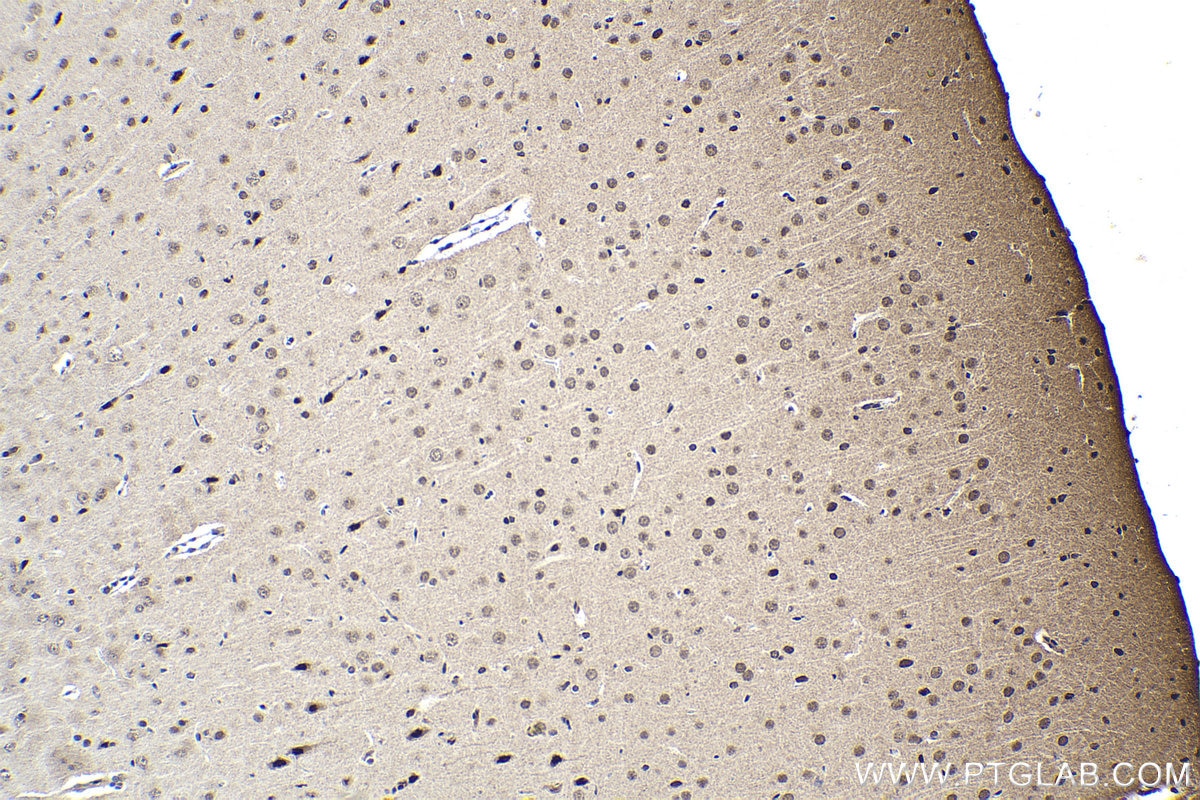 Immunohistochemistry (IHC) staining of rat brain tissue using FGF-2 Polyclonal antibody (11234-1-AP)