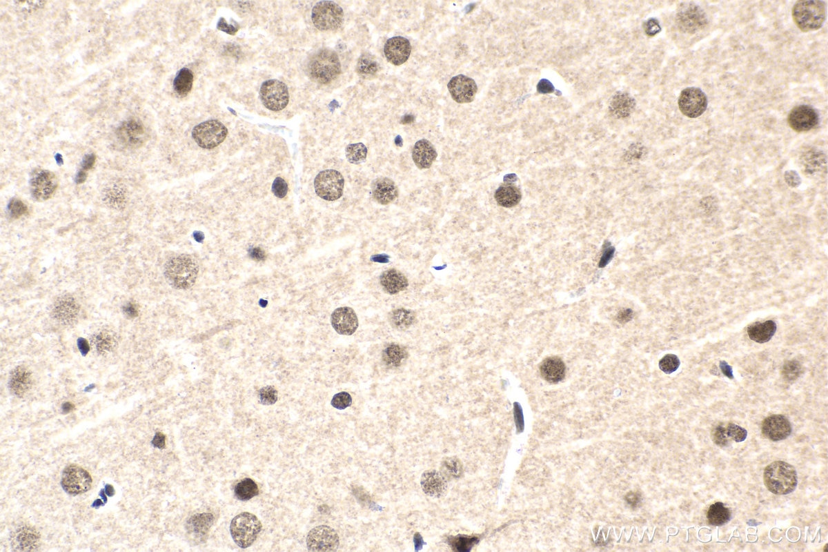Immunohistochemistry (IHC) staining of rat brain tissue using FGF-2 Polyclonal antibody (11234-1-AP)
