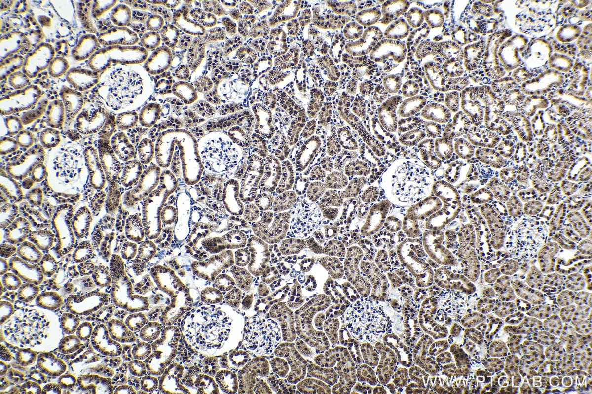 Immunohistochemistry (IHC) staining of rat kidney tissue using FGF-2 Polyclonal antibody (11234-1-AP)