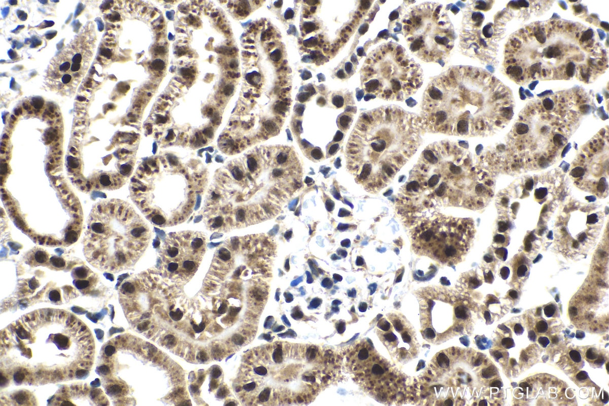Immunohistochemistry (IHC) staining of rat kidney tissue using FGF-2 Polyclonal antibody (11234-1-AP)