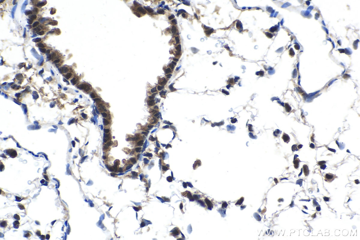 Immunohistochemistry (IHC) staining of rat lung tissue using FGF-2 Polyclonal antibody (11234-1-AP)