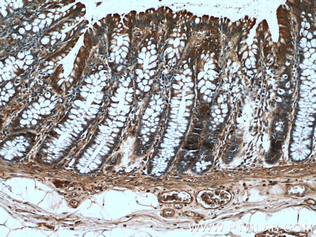 Immunohistochemistry (IHC) staining of human colon tissue using FGF21 Polyclonal antibody (26272-1-AP)