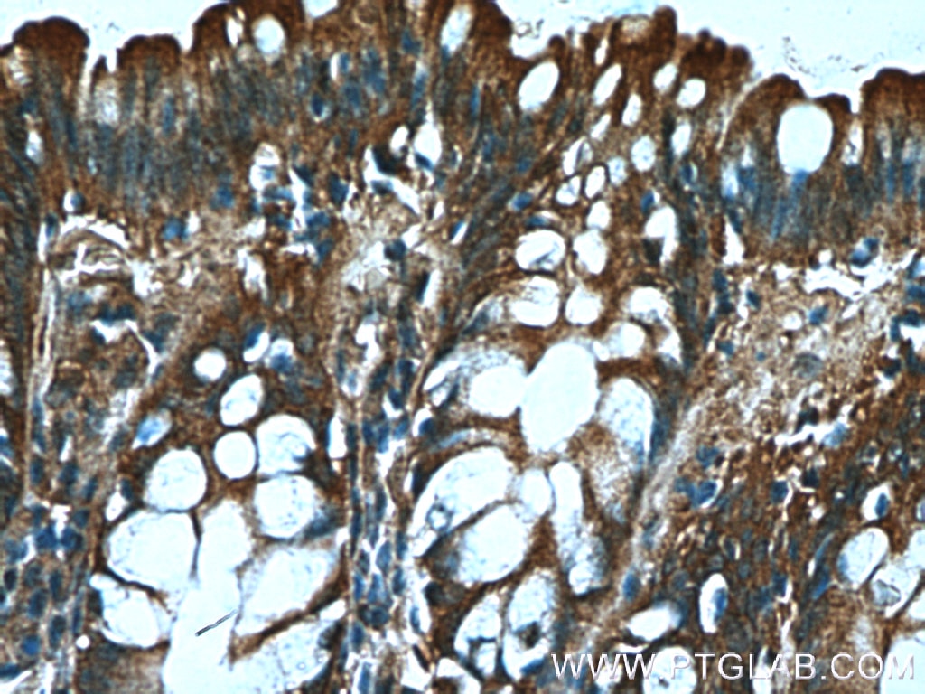 Immunohistochemistry (IHC) staining of human colon tissue using FGF21 Polyclonal antibody (26272-1-AP)