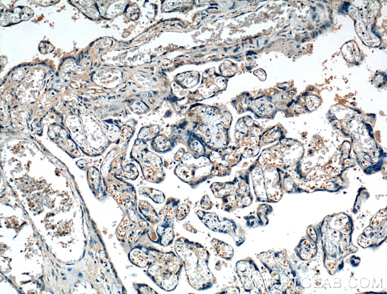 Immunohistochemistry (IHC) staining of human placenta tissue using FGF3 Polyclonal antibody (27100-1-AP)