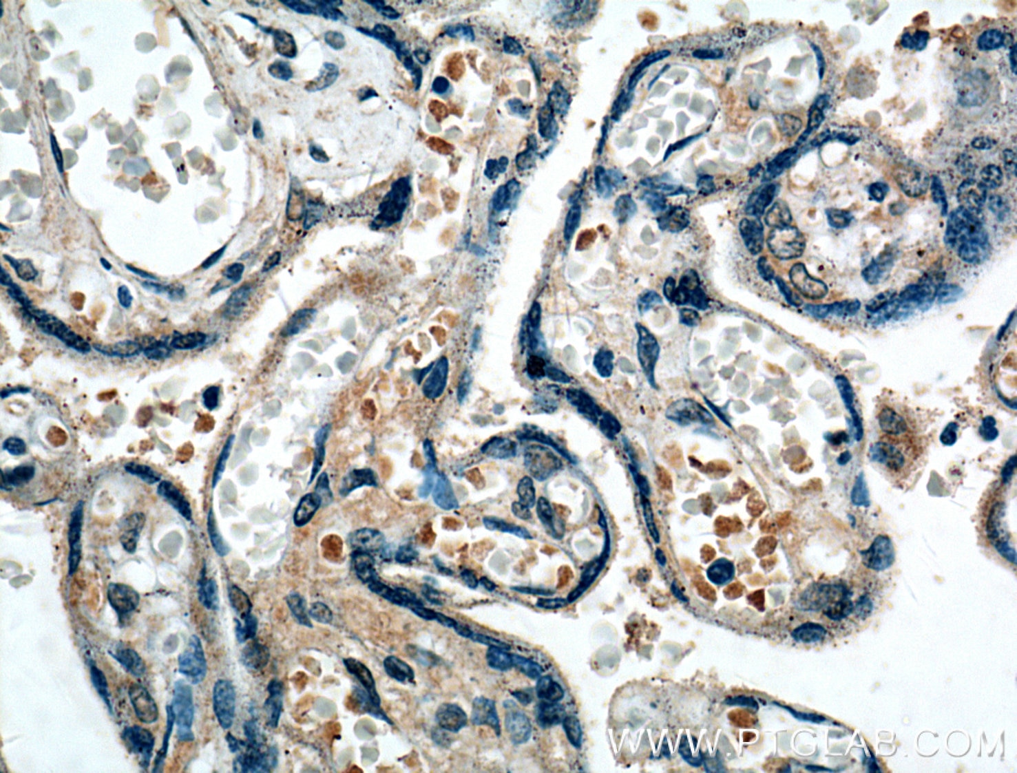 Immunohistochemistry (IHC) staining of human placenta tissue using FGF3 Polyclonal antibody (27100-1-AP)